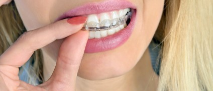 חריקת שיניים